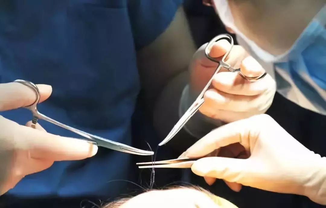 抬头纹法令纹鱼尾纹克星能管用吗,抬头纹鱼尾纹法令纹均可改善