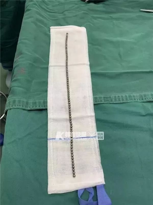 三岁女童身体散发臭味真相,妈妈发现女儿身上有臭味