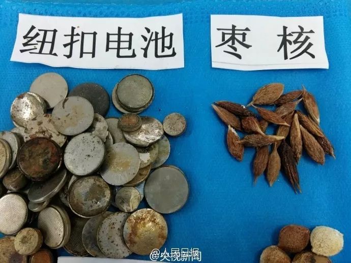 三岁女童身体散发臭味真相,妈妈发现女儿身上有臭味