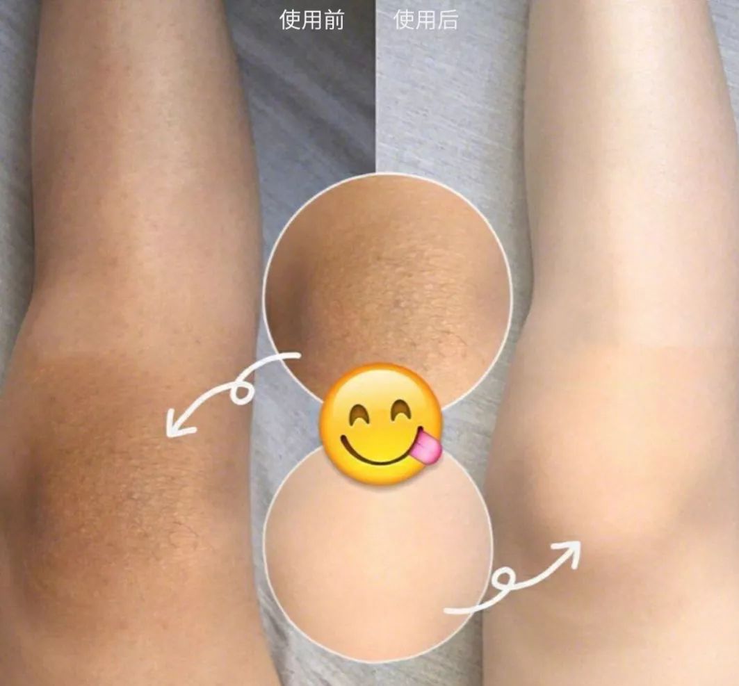 液体*袜丝**是什么鬼？用过的妹子都尖叫！黑腿瑕疵都没了