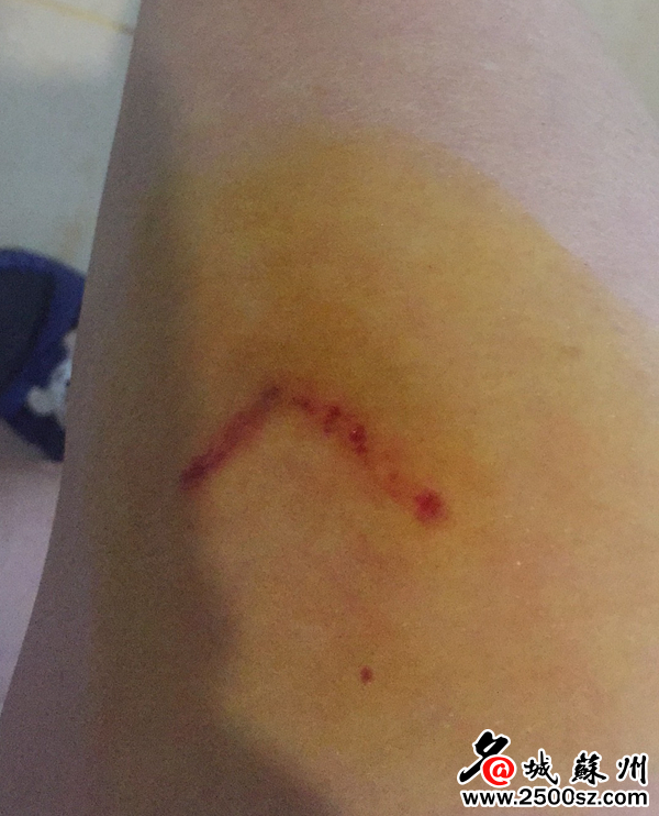 学校驱逐流浪狗防止学生被咬,大学生喂流浪狗被咬伤