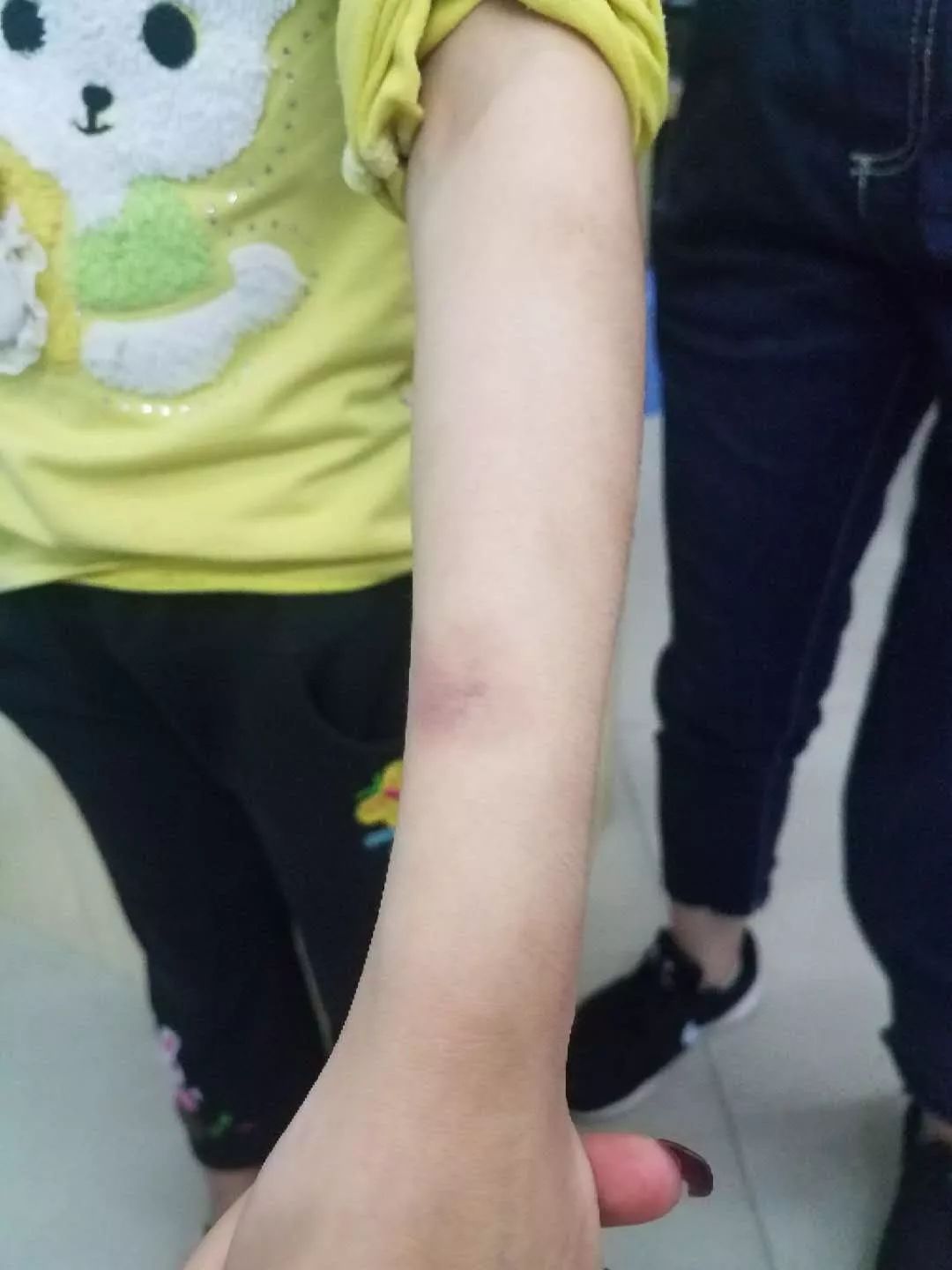 女童遭家暴送医后死亡,河源女婴被爸爸暴打