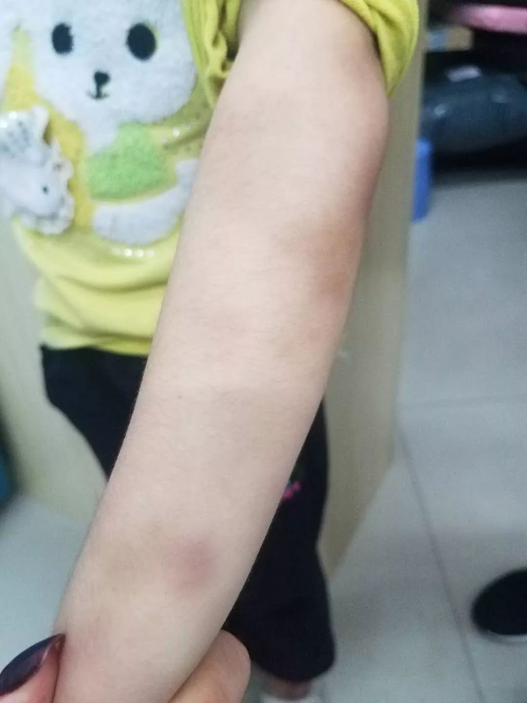 女童遭家暴送医后死亡,河源女婴被爸爸暴打