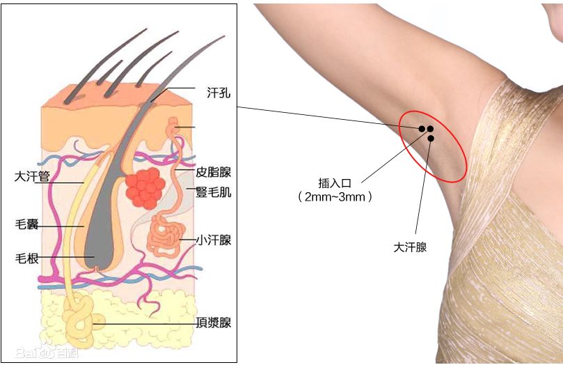 法国香体神器~夏季祛体味除汗臭腋臭，做个香气Girl