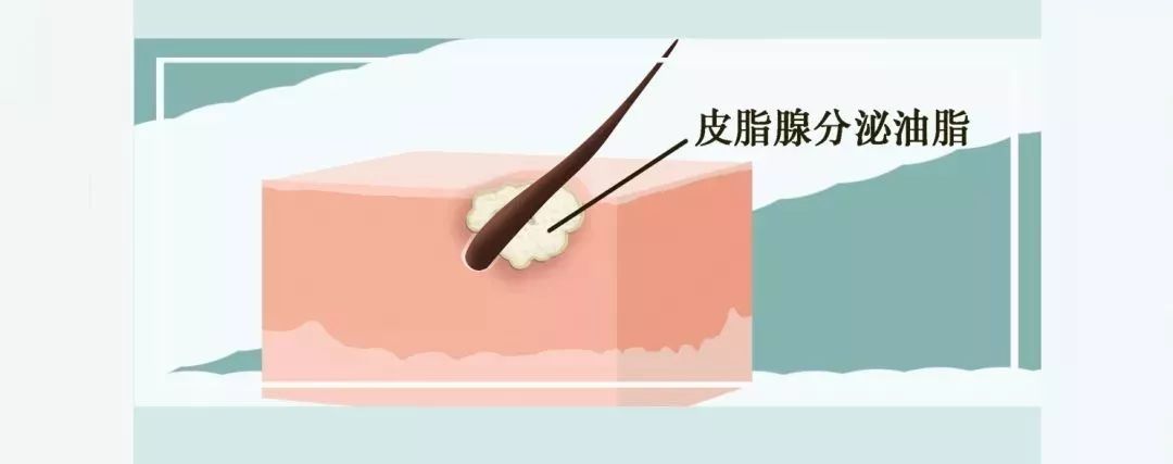 三角区的痘痘千万不要碰,三角区祛痘科普