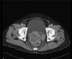 pubmed文献分析,pubmed高分文献