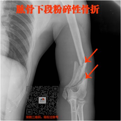 执医技能：X线阅片，全是套路，超简单