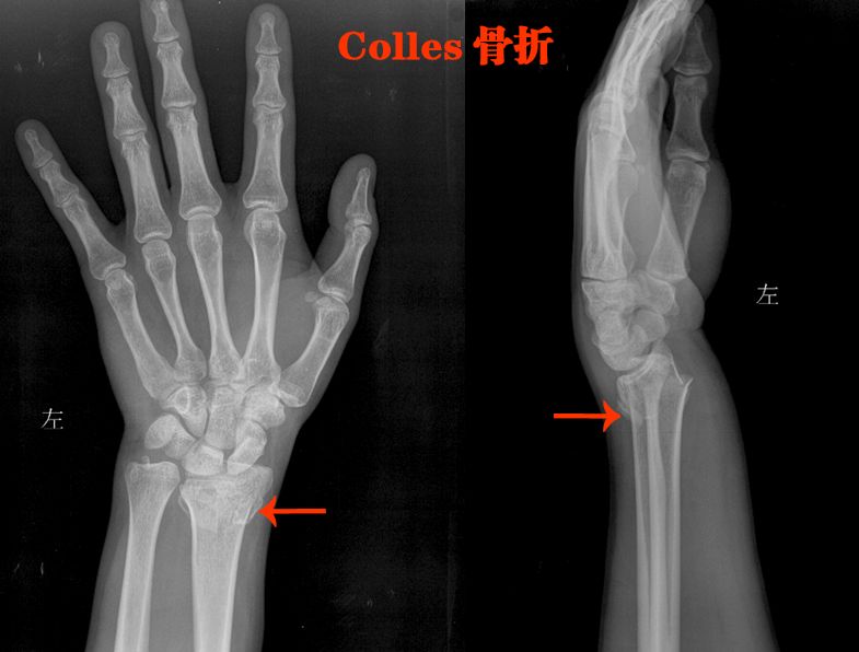 执医技能：X线阅片，全是套路，超简单