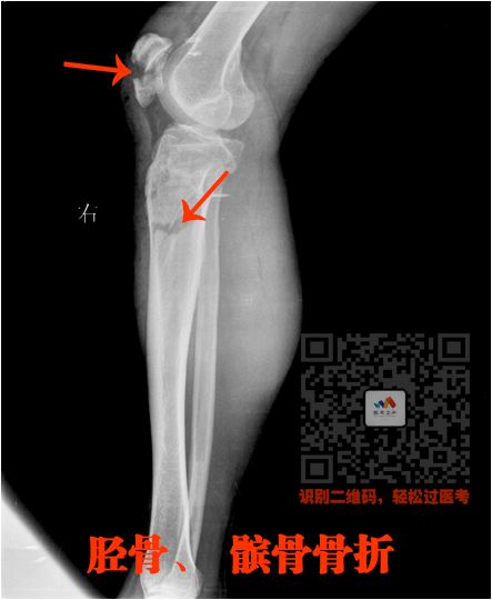 执医技能：X线阅片，全是套路，超简单