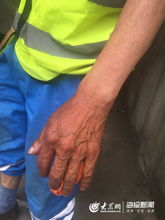 致敬高温下的菏泽户外工作者：手臂晒出“黑白分界线”