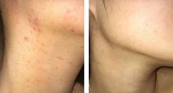 胡庆余堂红豆薏米丸,胡庆余堂薏米水