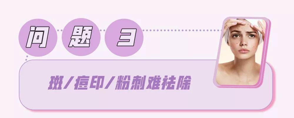 拯救夏日微瑕皮girl，请收下这份高能科普