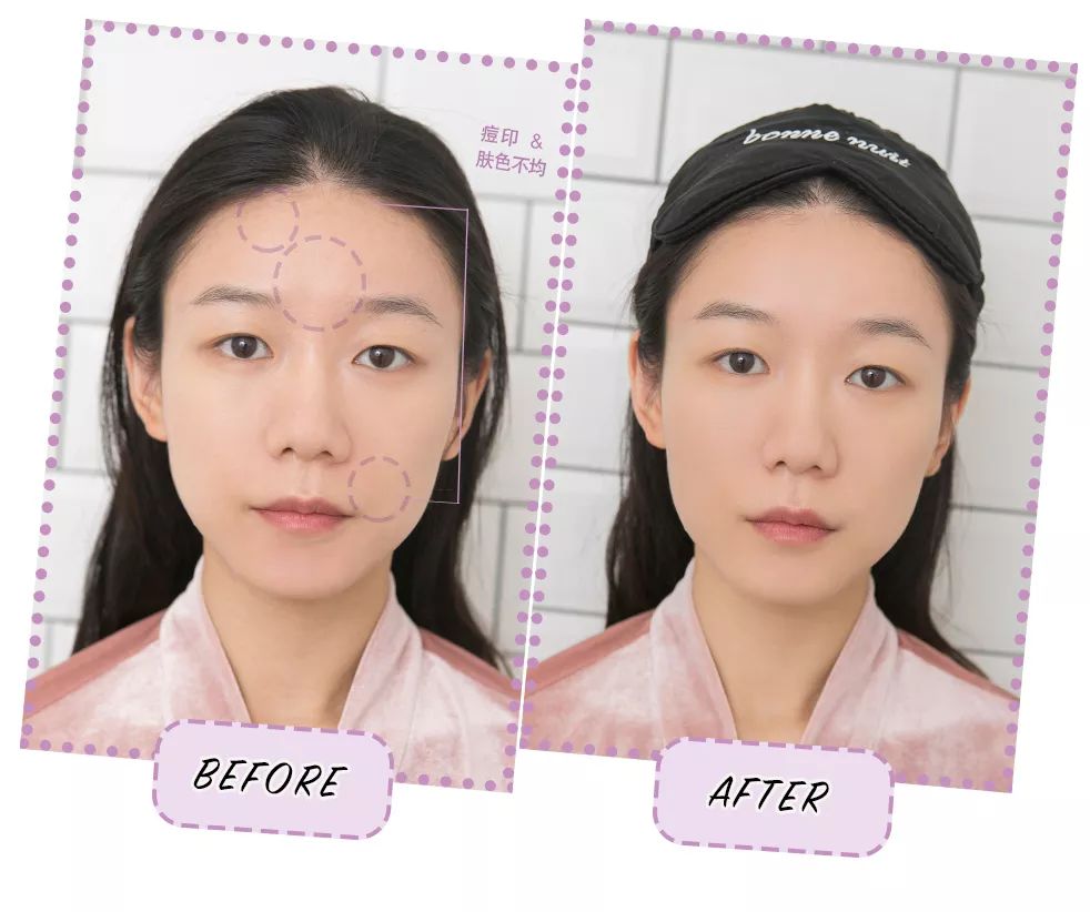 拯救夏日微瑕皮girl,请收下这份高能科普