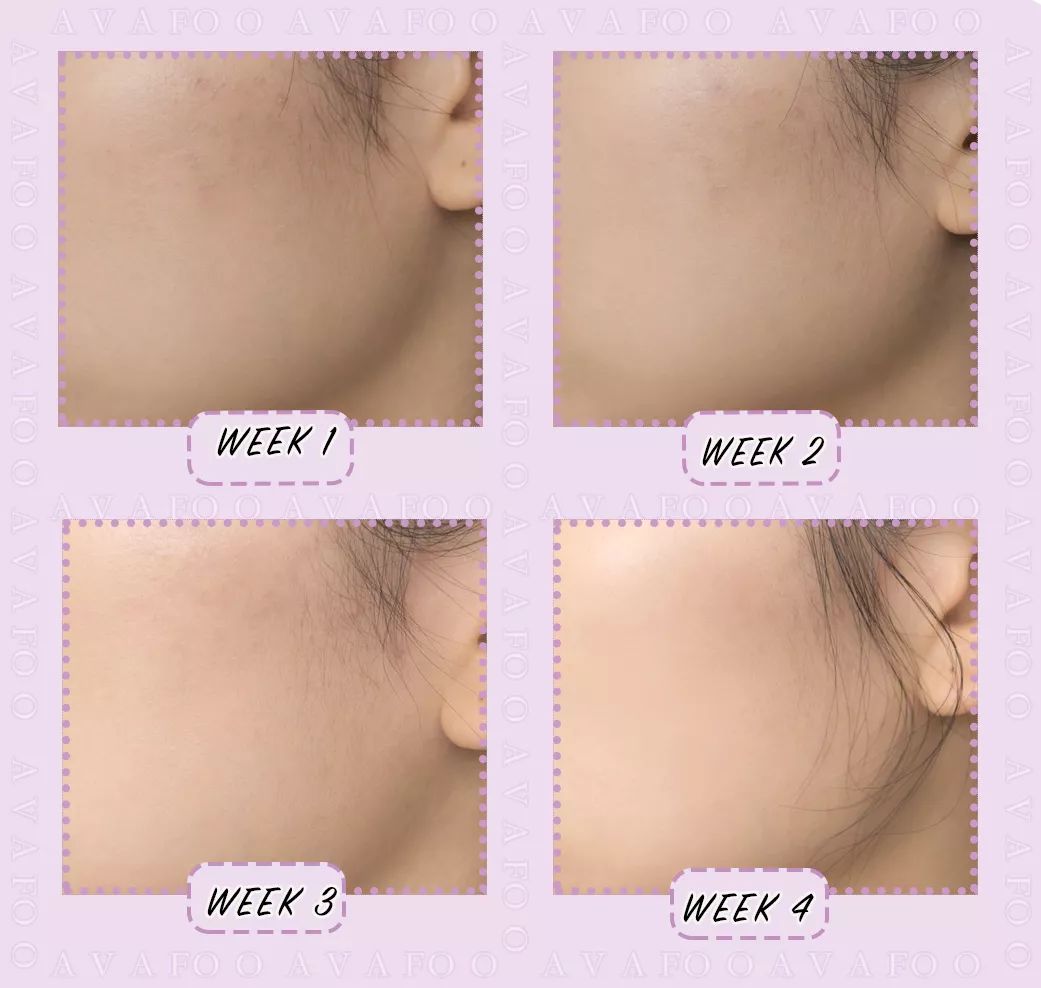 拯救夏日微瑕皮girl,请收下这份高能科普