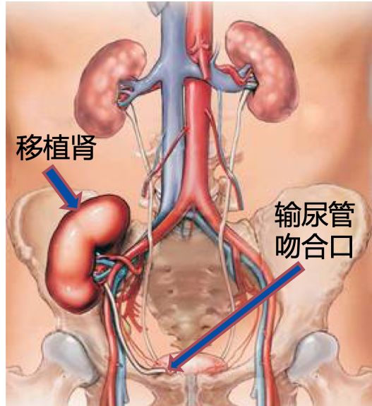 鐢熷懡鎺ュ姏鍣ㄥ畼绉绘鎴愬姛,鐢熷懡璧涜窇鎵嬫湳