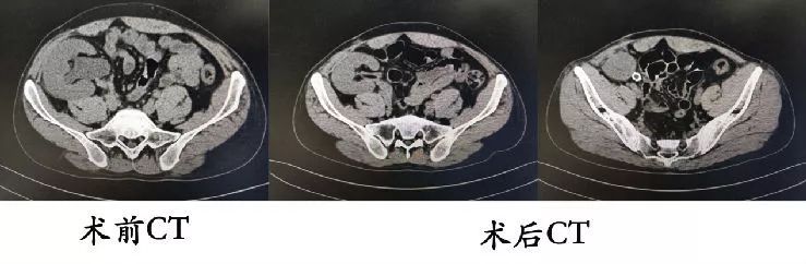 鐢熷懡鎺ュ姏鍣ㄥ畼绉绘鎴愬姛,鐢熷懡璧涜窇鎵嬫湳