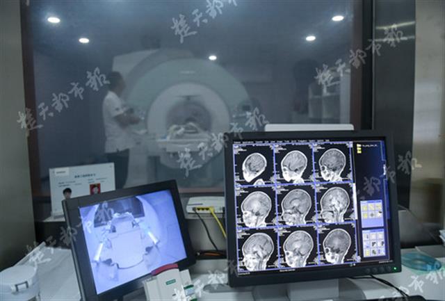 小孩做磁共振10个小时不出报告,一岁半孩子医生让做脑部核磁共振