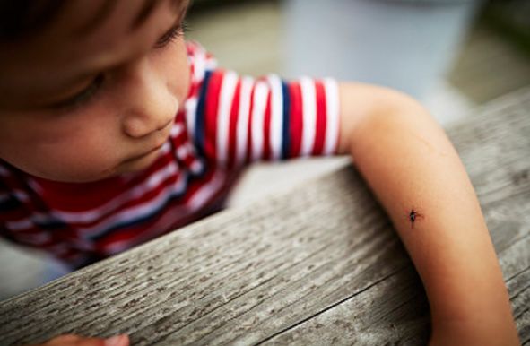 小儿被蚊子咬了怎么消肿止痒最快,被蚊子叮咬后用盐能快速止痒