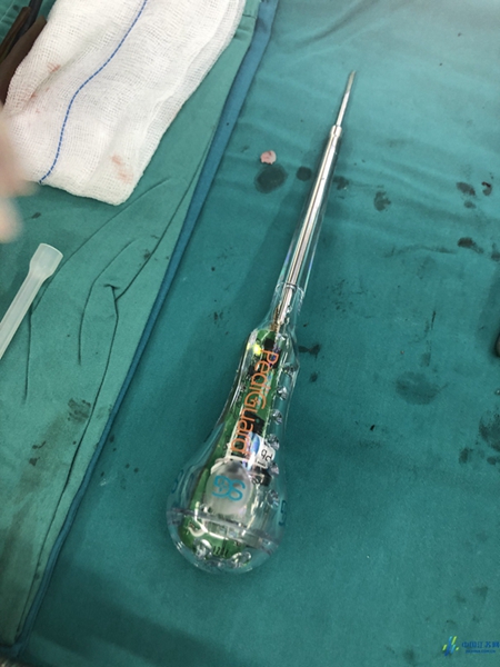 江苏伸筋脊疗强体机器人,开展首例导航机器人辅助骨科手术