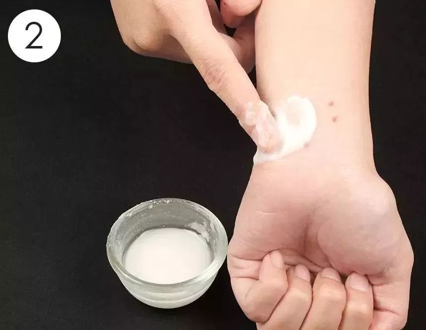 总被蚊子咬？涂点这个马上止痒，还不花一分钱