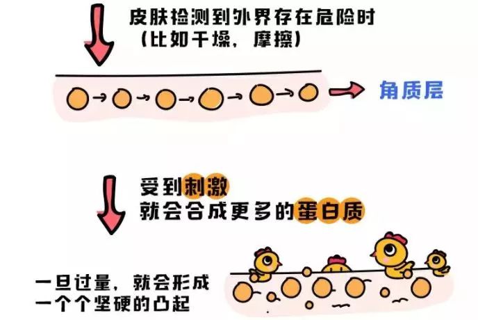 鸡皮肤怎么穿露背装,短期内快速去除鸡皮肤