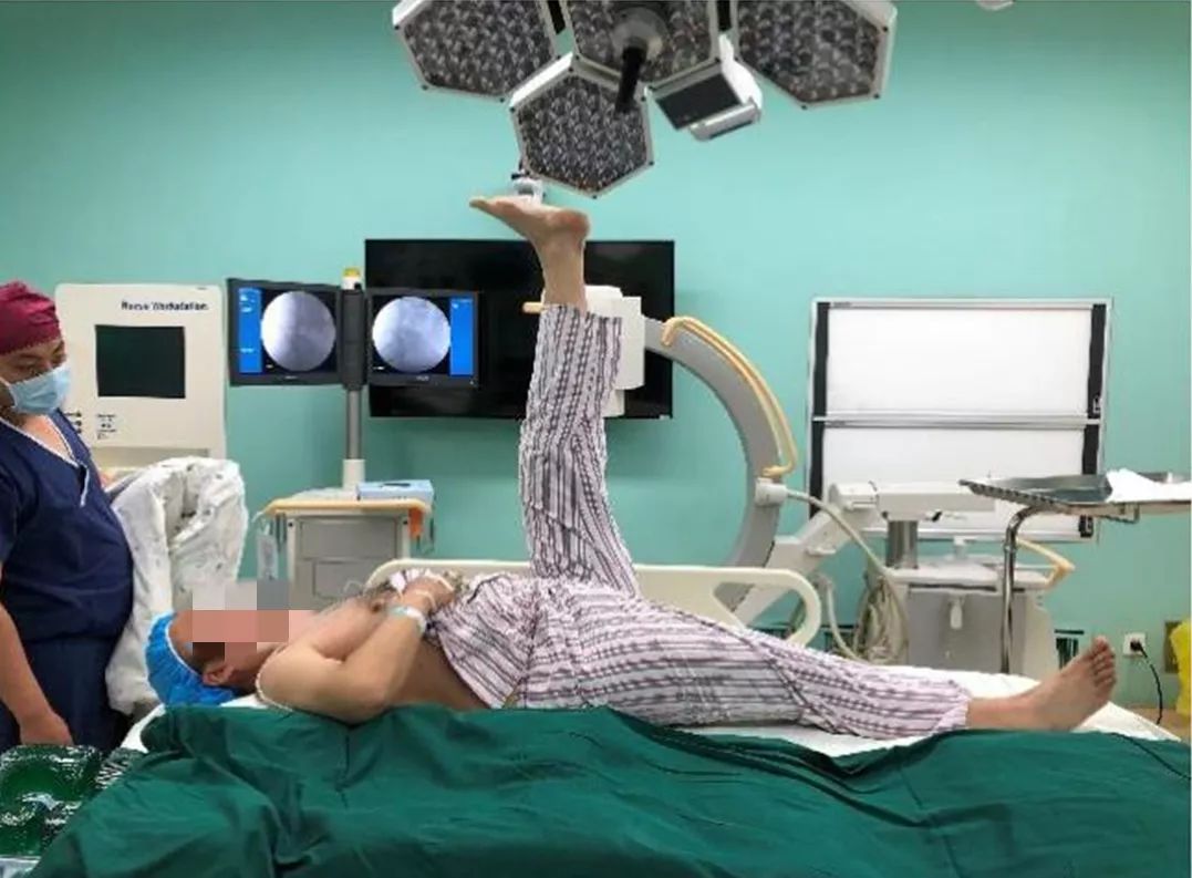 腰椎间盘突出椎间孔镜手术指南,椎间孔镜微创治疗腰椎间盘突出症