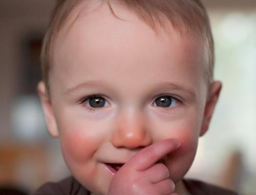 秋冬换季皮肤过敏怎么办十大措施,宝宝脸过敏了最快的补救方法