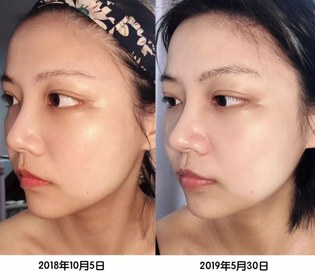 雅诗兰黛小棕瓶眼部精华618活动,618好物节雅诗兰黛小棕瓶精华