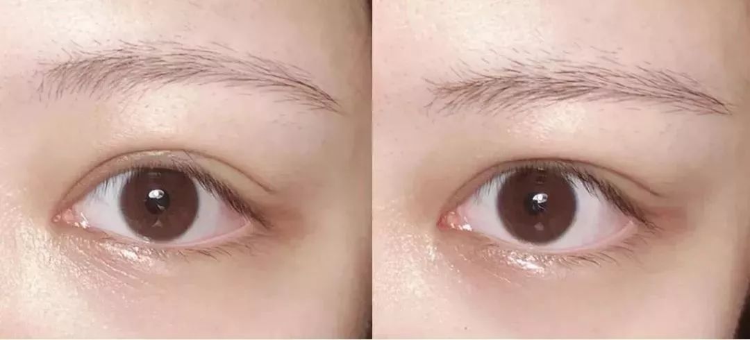 雅诗兰黛小棕瓶眼部精华618活动,618好物节雅诗兰黛小棕瓶精华