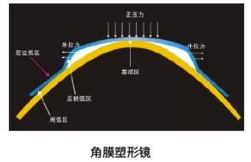 爱眼日保护眼睛宣传,爱眼日关爱眼睛保护视力