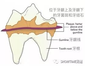 养在宠物嘴巴里的“武装分子”，了解一下。「919宠物爱牙科普」
