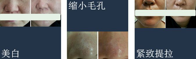 有必要用哪一款水乳,一辈子就能用一套水乳