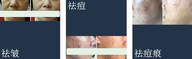 有必要用哪一款水乳,一辈子就能用一套水乳