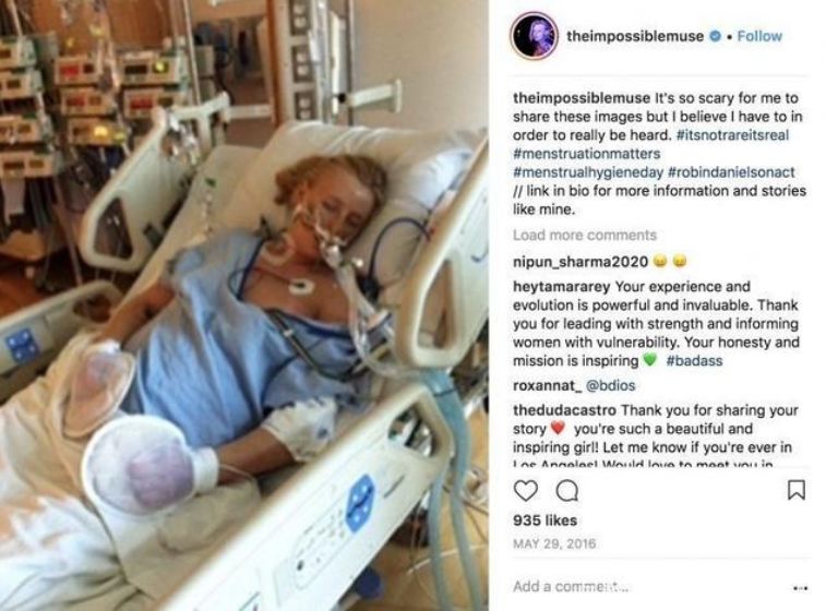 舒适度月经杯,最好用的姨妈杯