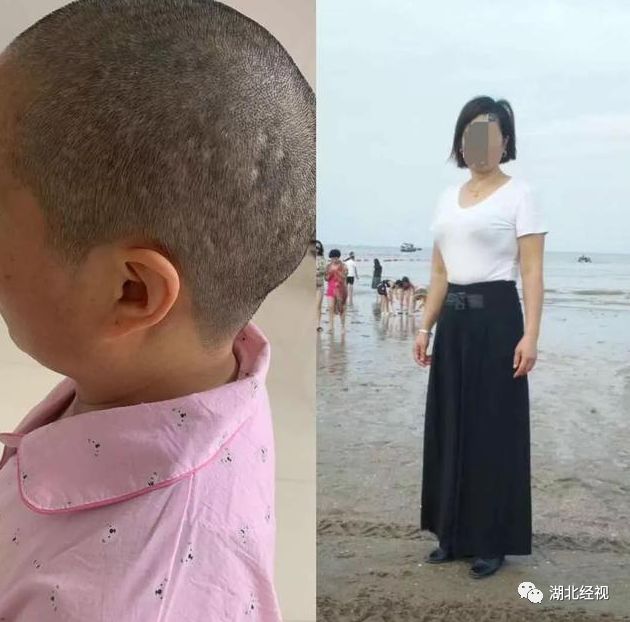 女子用了这种染发剂口吐白沫，两次进急诊！卖家说....