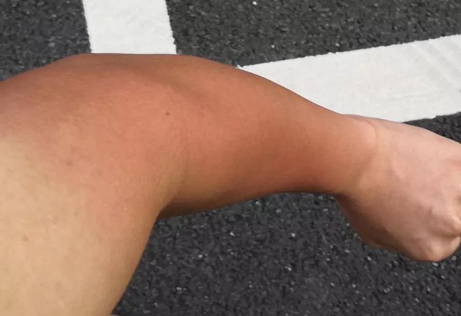 618美白抗氧化,618美白淡斑指南