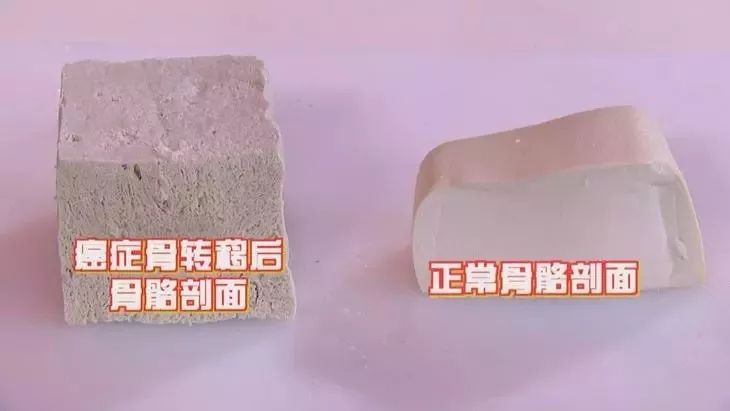 肺癌肩膀疼与肩周炎疼痛有啥区别,肺癌肩膀疼是一直疼还是一阵一阵