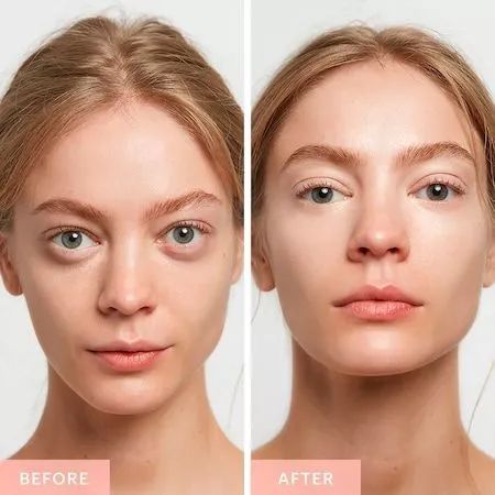 毛孔粗大的克星精华,毛孔粗大什么药材可以改善