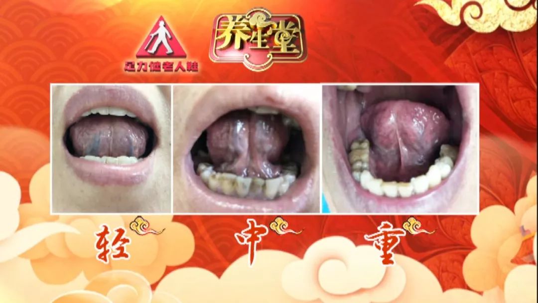 养生堂今日播出,养生堂今日播出的节目