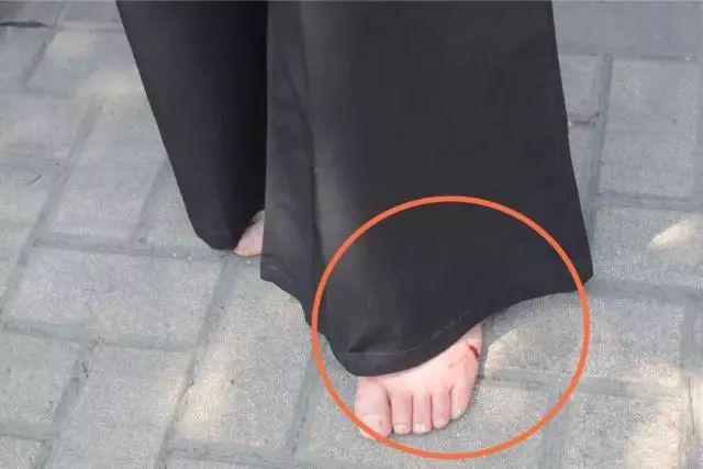 8厘米？女司机连撞3车伤1人！又是它惹的祸！