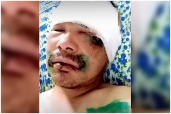 被熊堵了怎么办？咬它舌头