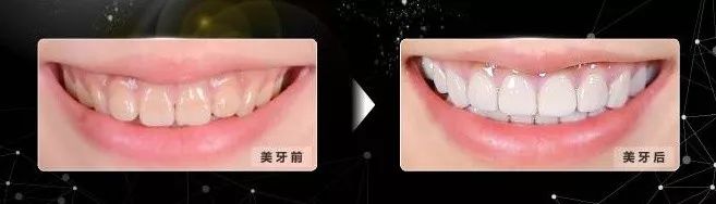 缺牙修复补贴政策,缺牙补牙补贴