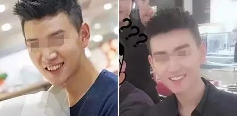 缺牙修复补贴政策,缺牙补牙补贴