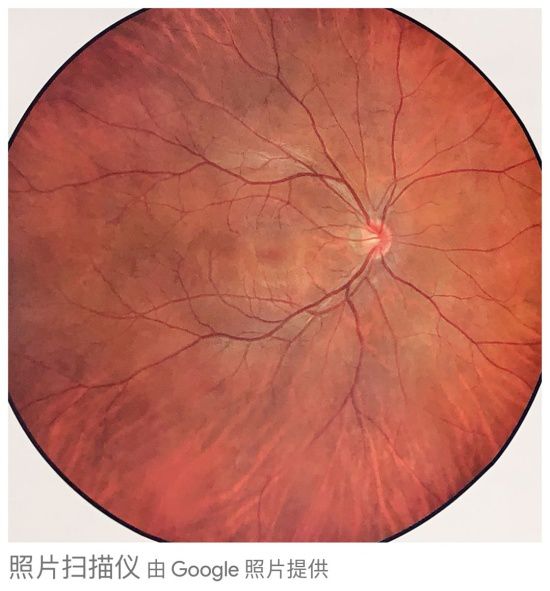 眼底黄斑病变一般多久会失明,眼底黄斑病的养护和注意事项