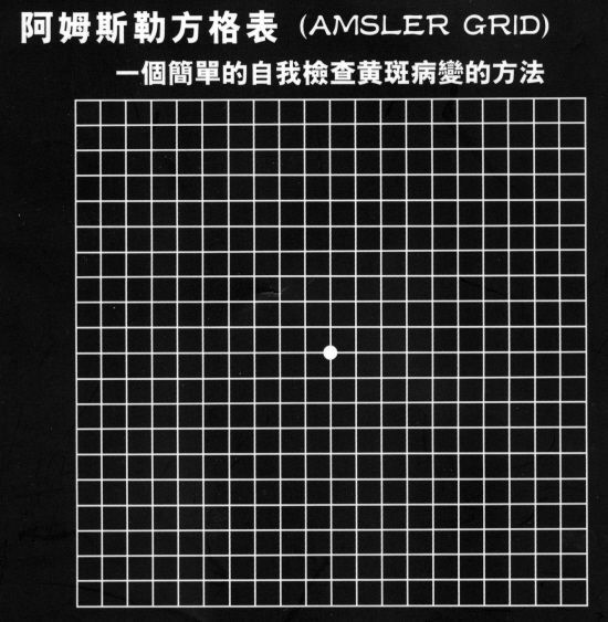 眼底黄斑病变一般多久会失明,眼底黄斑病的养护和注意事项