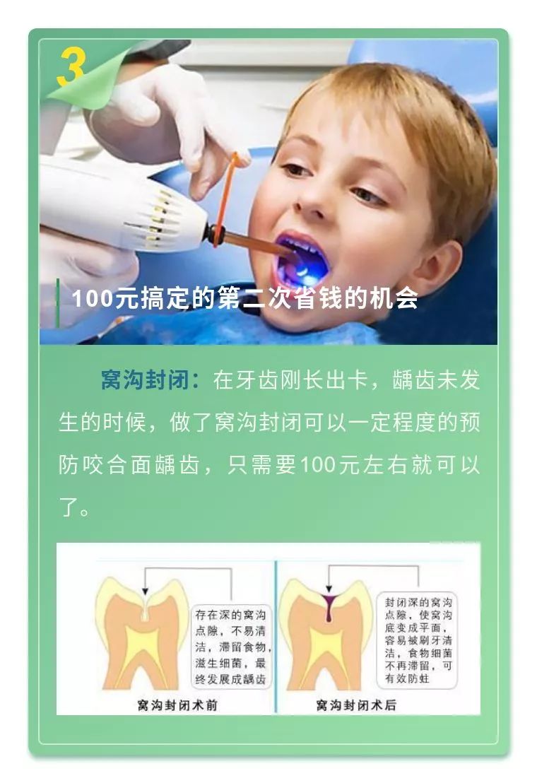 看牙齿最省钱方法,看牙太贵怎么才能健康又实惠