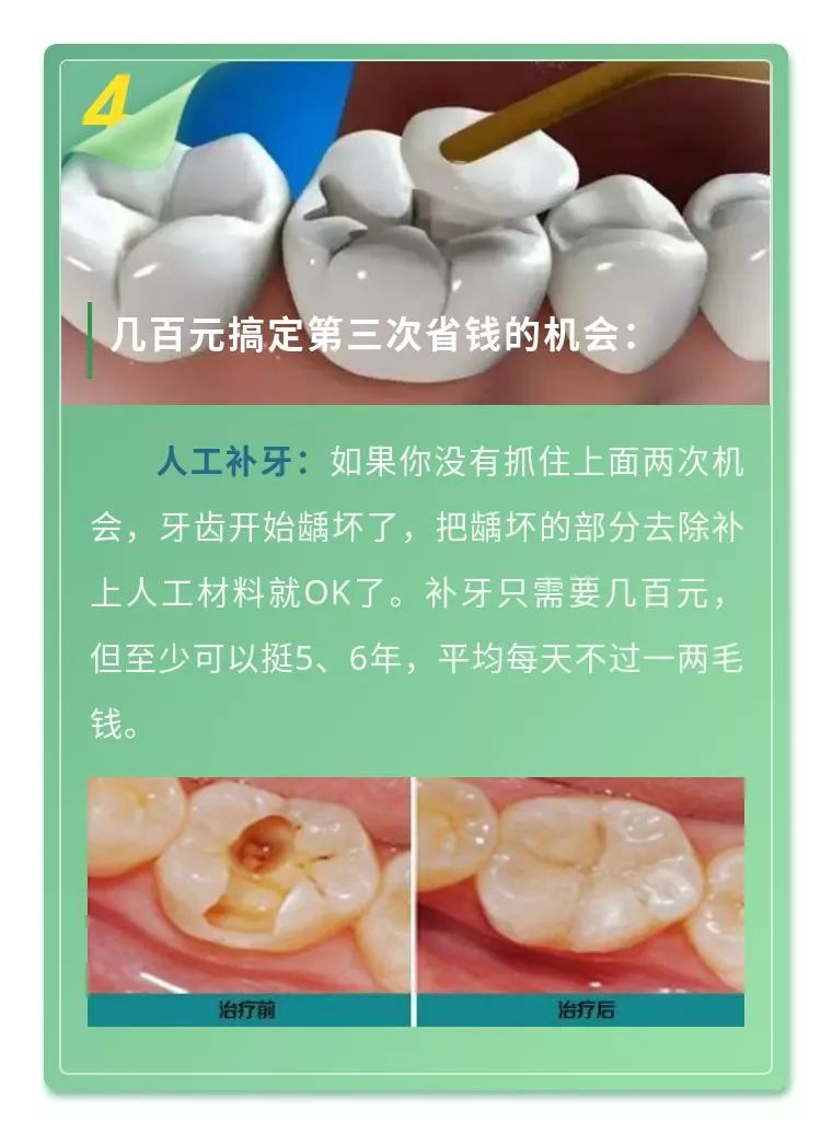 看牙齿最省钱方法,看牙太贵怎么才能健康又实惠
