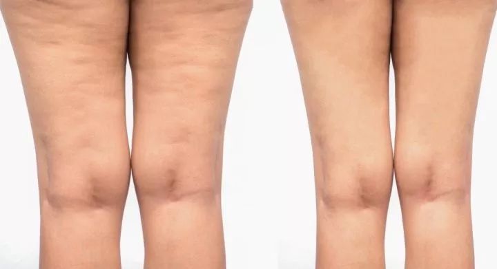 模特减肥一星期瘦二十斤,快速瘦肚子瘦腰懒人瘦身霜女