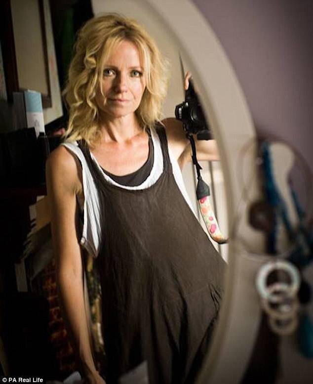 女子切除乳腺后勇敢拍“无胸”写真微笑面对