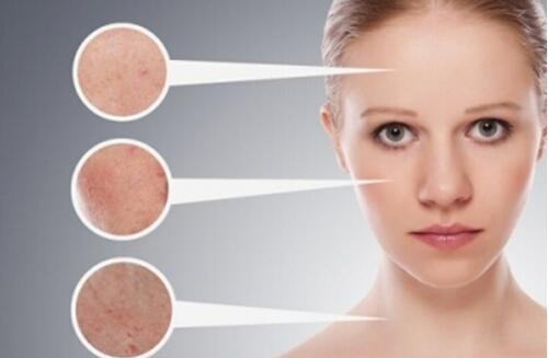 怎样知道自己脸上的斑是哪种斑,生完孩子脸上长斑怎么区分什么斑